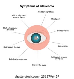 Sintomas de doença ocular por glaucoma infográfico e informação 