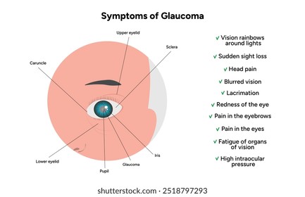 Sintomas de doença ocular por glaucoma infográfico e informação 