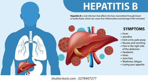 Symptoms of Hepatitis B Infographic illustration