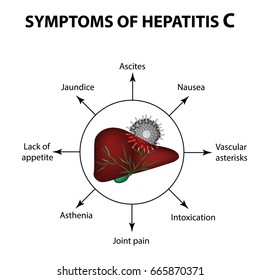 4,738 Hepatitis c Images, Stock Photos & Vectors | Shutterstock