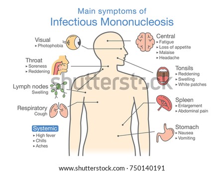 Symptoms of Infectious Mononucleosis disease. Diagram for diagnose patient of doctor. Stock photo © 