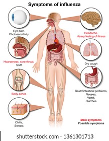 Symptoms Of Influenza 3d Medical Vector Illustration On White Background Isolated Infographic