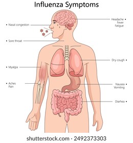 symptoms of influenza in different parts of the human body diagram hand drawn schematic vector illustration. Medical science educational illustration