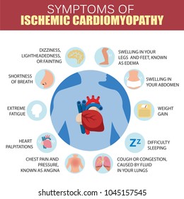 Cardiomyopathy Images, Stock Photos & Vectors | Shutterstock