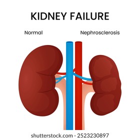 Symptome der Nierennephrosklerose