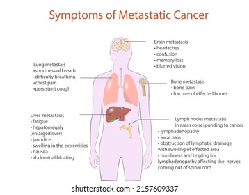 symptoms of metastatic cancer, vector, medical diagram