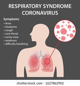 Symptoms of Middle East respiratory syndrome coronavirus in human lungs (MERS-CoV). 2019-nCoV. Concept design. Vector illustration in flat style isolated over black background.