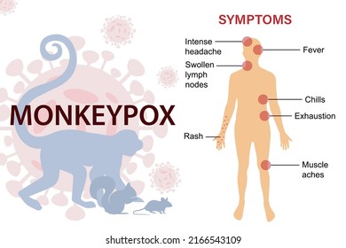 Symptoms of the monkey pox virus. The epidemic virus spreads from animals such as monkeys, squirrels, rats.  This causes skin infections.