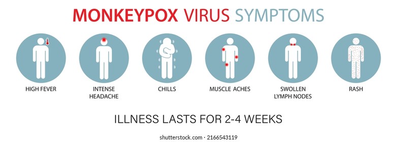 Symptoms of the monkey pox virus. Monkey pox is spreading. This causes skin infections. Infographic of symptoms of the monkey pox virus