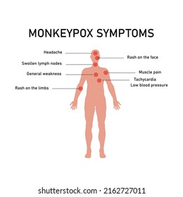Symptoms of monkey pox.Monkeypox virus zoonotic viral disease that can infect human, nonhuman primates. Monkey pox. Vector illustration