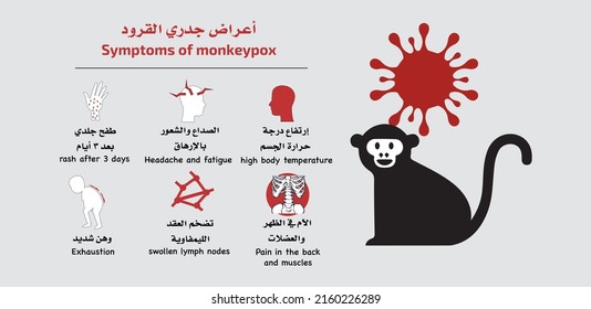 Symptoms of monkeypox virus written in Arabic and English