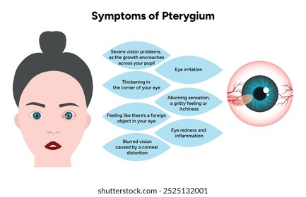 Symptome von Pterygium und Pinguecula Optometrie 
