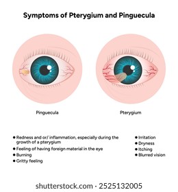 Sintomas de pterígio e doença de optometria pinguécula 