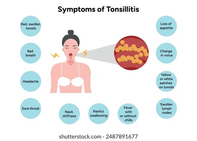 Symptoms of tonsillitis woman with open mouth streptococcus staphylococcus aureus. Vector illustration. EPS10