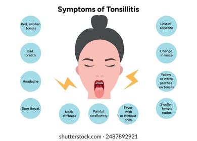 Symptoms of tonsillitis woman with open mouth. Streptococcus staphylococcus aureus. Vector illustration. EPS10