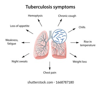 Symptome der Tuberkulose als Text. Bild einer mit Kochs Tuberkelbazillus infizierten Lunge. Vektorillustration im Flachstil einzeln auf weißem Hintergrund.