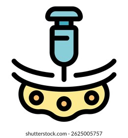 Seringa que injeta líquido nas células, representando modificação genética, terapia celular, imunoterapia e terapia gênica