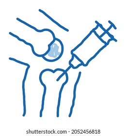Syringe Injection Vaccine In Bone sketch icon vector. Hand drawn blue doodle line art isolated symbol illustration