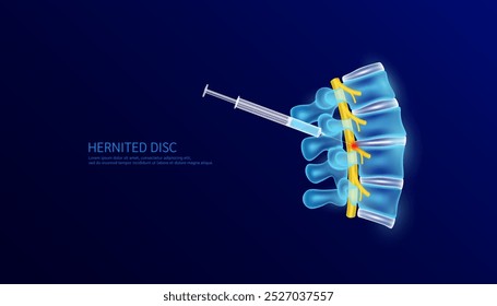 Jeringa y médula espinal amarilla. Inyecciones para el dolor relacionado con la hernia discal. Órgano humano de anatomía vertebral sobre fondo azul oscuro. Concepto de tratamiento médico. Anuncio Vector EPS10.