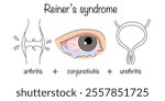 A systemic disease that includes a triad of symptoms: inflammation of the joints, inflammation of the genitourinary system and inflammation of the mucous membrane of the eyes. Reiter