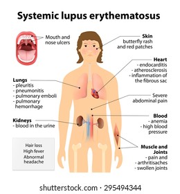 lupus symptom svenska