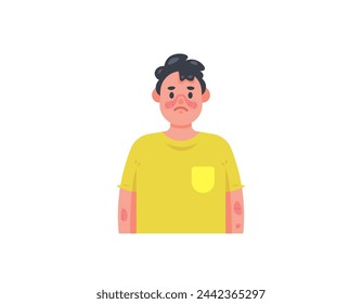 Enfermedad sistémica de lupus eritematoso. Un hombre que sufre de lupus. Erupción roja en la cara y los brazos. Enfermedad autoinmune. Problemas de salud. Expresiones faciales de las personas. Diseño de ilustración de personajes