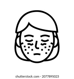 systemic lupus erythematosus line icon vector. systemic lupus erythematosus sign. isolated contour symbol black illustration