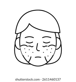 systemic lupus erythematosus line icon vector. systemic lupus erythematosus sign. isolated contour symbol black illustration