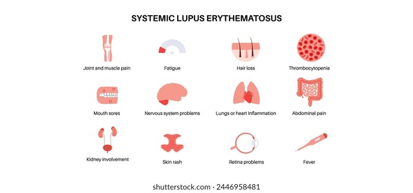 Systemic lupus erythematosus medical poster. Butterfly or malar rash on a female face. Autoimmune disease concept. Inflammation and skin tissue damage, pain in the internal organs vector illustration