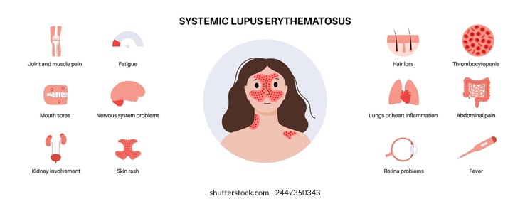 Systemic lupus erythematosus medical poster. Butterfly or malar rash on a female face. Autoimmune disease concept. Inflammation and skin tissue damage, pain in the internal organs vector illustration