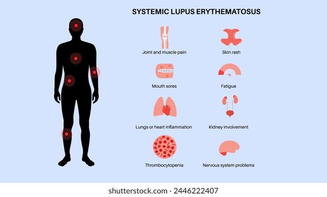 Systemic lupus erythematosus poster. Butterfly or malar rash, pain in the male body silhouette. Autoimmune disease concept. Inflammation skin tissue, the internal organs damage vector illustration