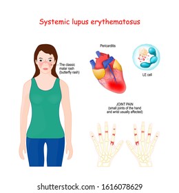 Systemic Lupus Erythematosus. SLE Or Lupus, Is A Autoimmune Disease. Woman With Red Spot On Her Face In Shape Of Butterfly. Vector Illustration