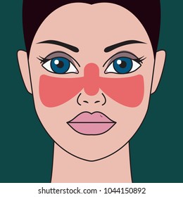 Systemic Lupus Erythematosus. Woman With Red Spot On Her Face In Shape Of Butterfly. Vector Illustration