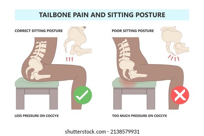 Tail bone pain floor hip spine sitting down back leg fall slip broken poor chair lower trauma tumor symptom joint surgery coccalgia good work from home computer ergonomic seating sacroiliitis