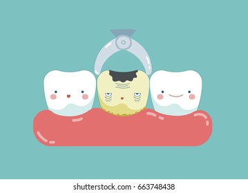 To take decayed tooth out ,teeth and tooth concept of dental 