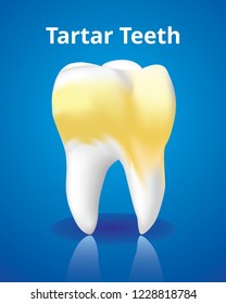 Tartar Tooth, Dental Care Concept, Realistic Design Illustration Vector.