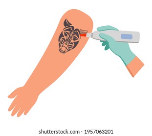 Tattoo removal from skin hand.Vector flat illustration.Removal procedure unwanted tattoos.