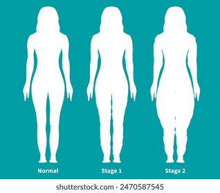 Teal Lipedema Silhouette Illustration with Woman with Normal and Lipedema Stages