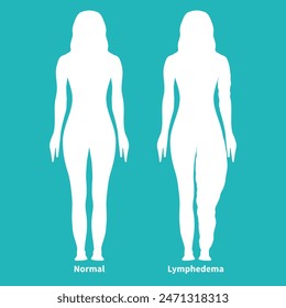 Teal Lymphedema Silhouette Illustration with Woman with Normal and Lipedema