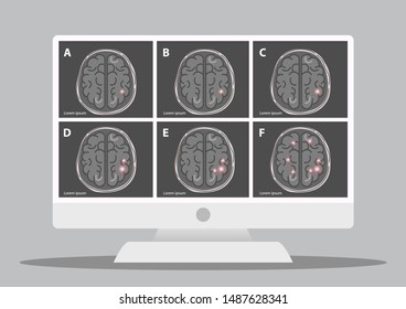 A team of doctors is diagnosing the brain.  Mental health concept. Solving mental problems. Psychotherapy and help.Flat vector illustration.