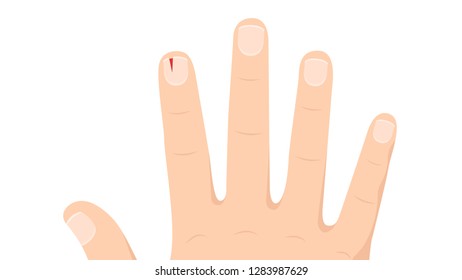 Royalty,Free Cutting Nail Cartoon Stock Images, Photos