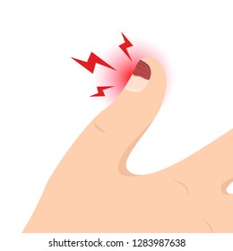 Tear nails cartoon vector. free space for text. wallpaper. copy space. Thumb vector.