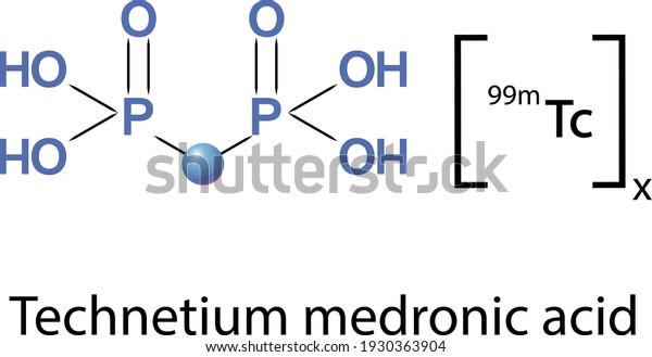 Technetium medronic acid is a
pharmaceutical product used in nuclear medicine to localize bone
metastases