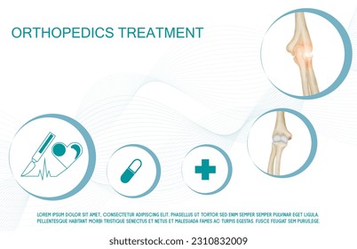Technology for treatment of elbow bone. Abstract traumatology and orthopedics. Medical science in the hospital for body joints.