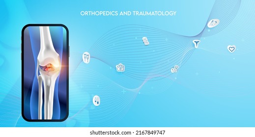 Technologie zur Behandlung von Knochen. Abstrakte Traumatologie und Orthopädie. Medizinische Wissenschaft im Krankenhaus für Körpergelenke.