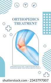 Technology for treatment of knee and joint bone injury. Abstract traumatology and orthopedics. Medical science in the hospital for body joints.