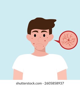 Teenager boy has skin problems with acne or allergic pimples on her face. Skincare and dermatology concept. Flat style vector illustration.