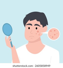 Teenager boy has skin problems with acne or allergic pimples on her face. Skincare and dermatology concept. Flat style vector illustration.