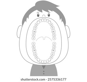 The teeth of an adult in the permanent dentition stage with a wide-open mouth.