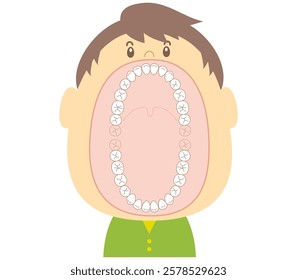 The teeth of an adult in the permanent dentition stage with a wide-open mouth.